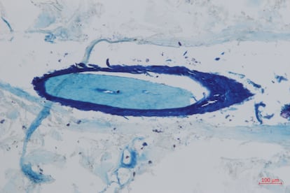 First observation of a mammoth hair follicle under the microscope, thanks to the sample from the female that died 52,000 years ago in Siberia.