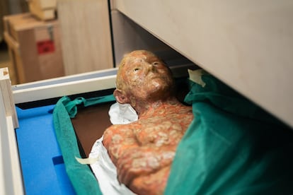 Figura de un hombre lleno de llagas, en una caja en el almacén del Museo Olavide, en Madrid.