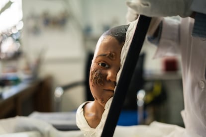 Figura de cera de un niño atendido en el desaparecido Hospital San Juan de Dios, en Madrid.