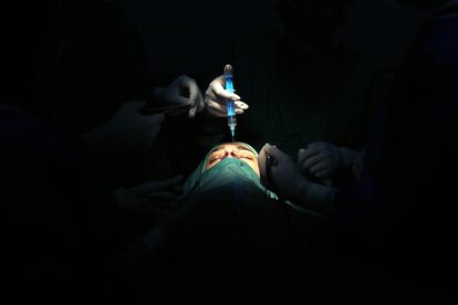 Una mujer se somete a una rinoplastia en Teherán, Irán, el 13 de octubre de 2023.